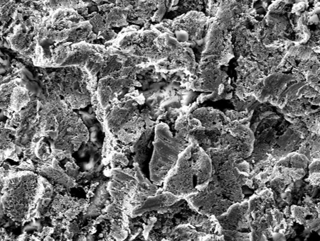 SEM × 1000 image of Normal plating